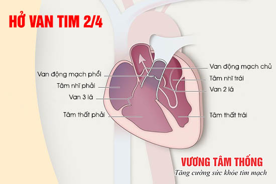 Dựa vào chỉ số xét nghiệm công thức máu có thể chẩn đoán và loại trừ nhiều bệnh lý