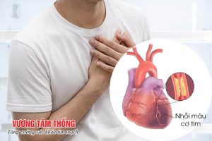 Thiếu máu cơ tim cục bộ có nguy hiểm không? – 3 biến chứng cần biết